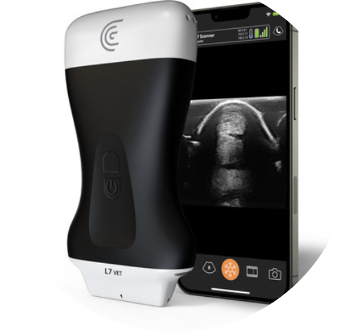 Link to video about Clarius wireless ultrasound